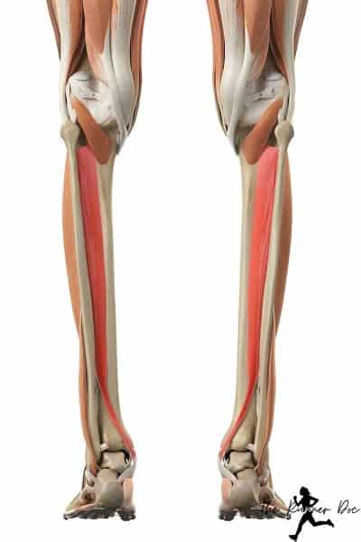 Fix posterior tibial tendon dysfunction in runners
