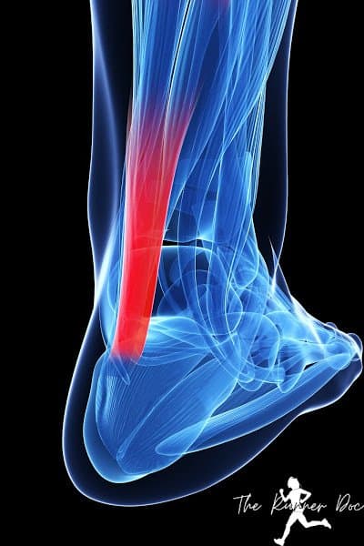 Pain in the achilles tendon or heel from achilles tendinitis, fix achilles tendinopathy