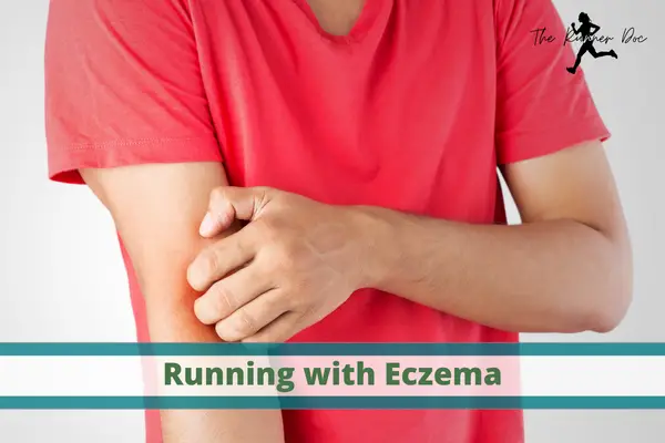 Running with eczema