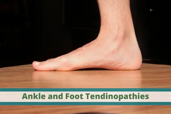 Running on the Edge: Understanding and Treating Tendinopathies of the Foot and Ankle
