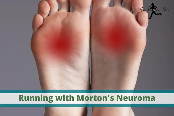 running with morton's neuroma