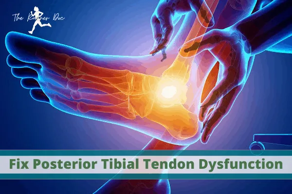 how to fix posterior tibial tendonitis