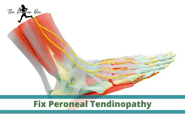 Running shoes store for peroneal tendonitis