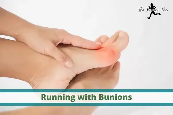 Bunion treatment 2025 for runners