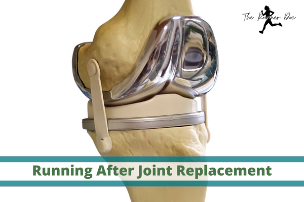 How to Run Safely after Total Joint Replacement: All Hope is Not Lost!